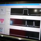 【ITS世界会議10】ドライバーの健康状態を読み取る座席　アイシン精機 画像