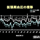 冬はヒートショックの季節……ミネラル入り麦茶の研究が発表 画像