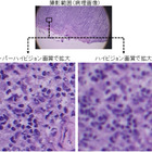 8K技術で遠隔医療！NTTデータ経営研究所らが実証実験へ 画像