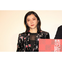 milet、頬が腫れた写真を投稿しファンざわつく「ほっぺが大変！」「突然びっくりする」 画像