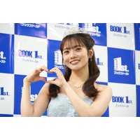 元日向坂46・宮田愛萌、腫れた顔をSNS公開！「そんなに腫れるの？」とファンも驚愕 画像