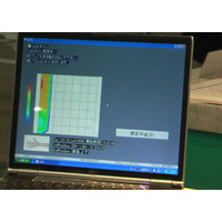 【ESEC 2011（Vol.10）:動画】応用電機、世界初の骨密度測定をデモ 画像