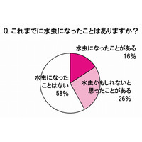 女性の水虫調査、半数が店で薬購入恥ずかしい……経験者4分の1が実際に買えず 画像