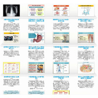 QLife、医師用iPadアプリ向けに患者説明スライドのライブラリを無料公開 画像