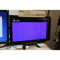 【NTT R＆Dフォーラム2014 Vol.2】弱点は胸毛……ウェアラブル生体センサーを東レと共同開発 画像