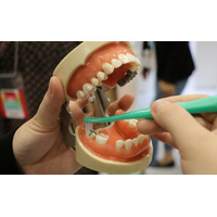 むし歯予防関連製品について歯科衛生士に聞く…『第7回 ワールドデンタルショー2014』 画像