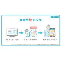 自宅でできる健康チェック「スマホdeドック」、KDDIが今夏より提供 画像