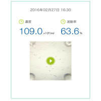 スマホで精子の濃度と運動率をチェック 画像