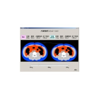 日立、体重と腹囲から腹部の疑似断層画像を表示するメタボ対策支援技術 画像