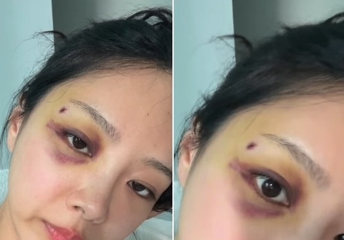 キム・スルギ