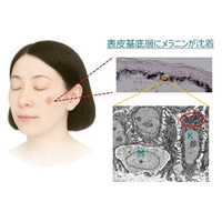 老化細胞が「掃除機」のようにメラニンを取り込む新事実を発見
