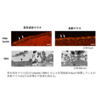脳室を守る“糖のバリア”が老化や出血で壊れる仕組みを解明