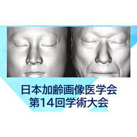 2025年11月開催【日本加齢画像医学会 第14回学術大会】 麻布ビューティクリニックより 加藤聖子医師が登壇