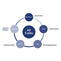 Alamar Biosciences、NULISAqpcr（TM）AD 5-plex アッセイの発売を発表、アルツハイマー病研究における血液ベースのバイオマーカー検出を前進