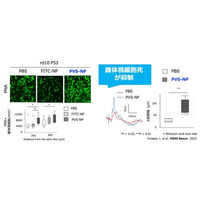 SENTAN Pharma、網膜色素変性症を対象にしたピタバスタチンナノ粒子製剤を開発、第1相医師主導治験を2026年度開始へ