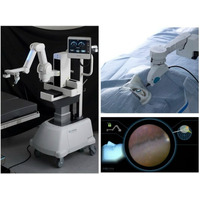 眼内内視鏡保持ロボット「OQrimo」による強膜圧迫を行わない周辺部網膜観察に成功