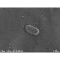 馬の呼吸器感染症から新種の細菌を発見