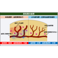 アレルギー性鼻炎を血管から治す 新しい仕組みによる治療法の可能性