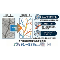 血管の複雑な形をAIで自動測定する新ツールを開発