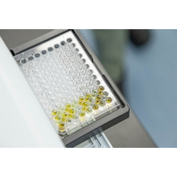 台湾の研究チーム、日本における慢性腎臓病（CKD）の早期管理に向けた精密なインドキシル硫酸検査の重要性を強調